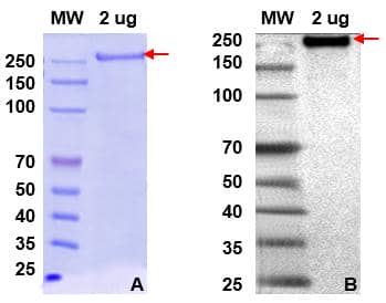 桿狀病毒-昆蟲細胞蛋白表達服務