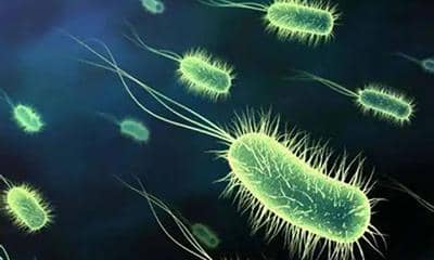 盤點(diǎn)大腸桿菌重組蛋白表達(dá)過程中的一些常見問題