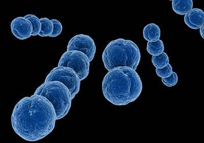 什么是原核蛋白表達(dá)系統(tǒng)?它的優(yōu)勢(shì)體現(xiàn)在哪些方面?