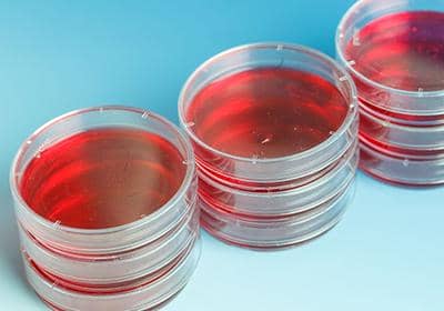 您了解培養(yǎng)基嗎?盤(pán)點(diǎn)細(xì)胞培養(yǎng)基使用的一些問(wèn)題