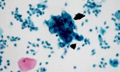 什么雜交瘤抗體測序?它的服務(wù)內(nèi)容有哪些?