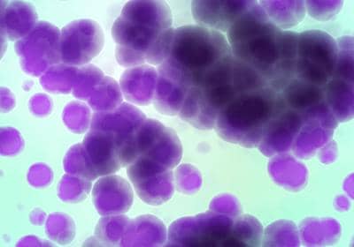 穩轉細胞株的構建-構建原理及其構建方法盤點