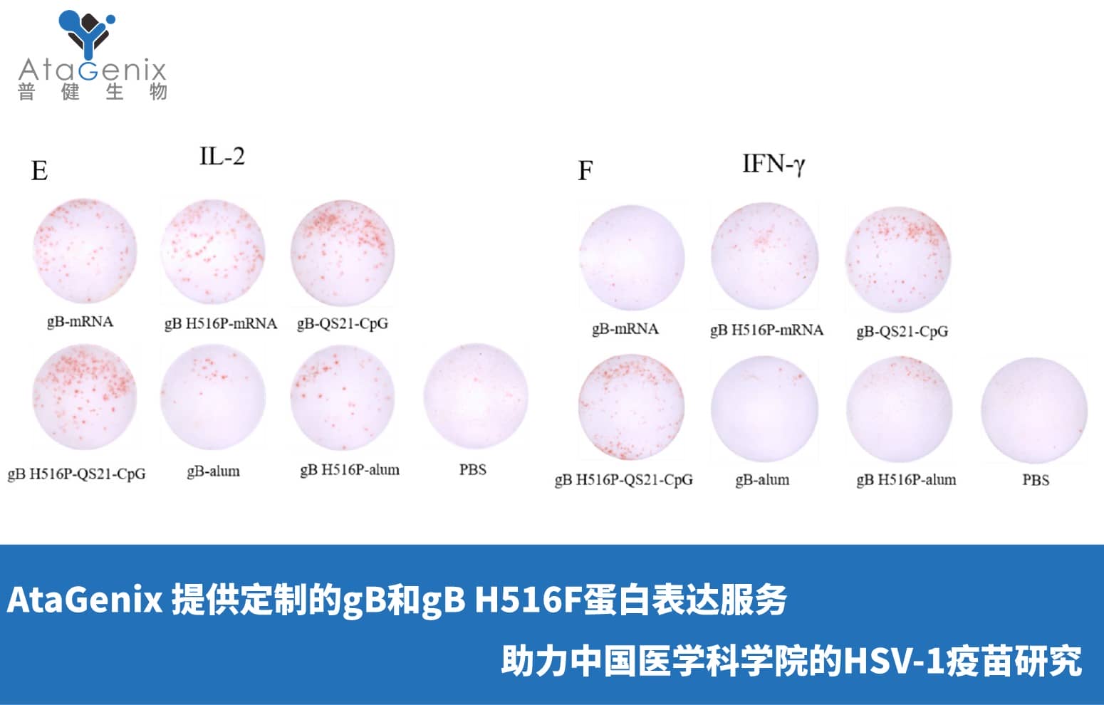 AtaGenix 提供定制gB和gB H516F蛋白表達服務，助力中國醫學科學院HSV-1疫苗研究