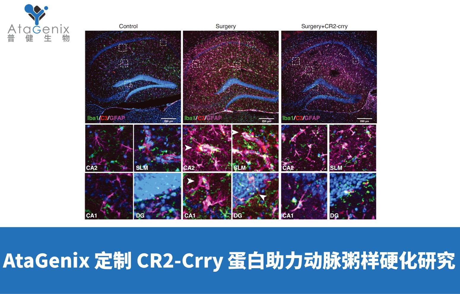 AtaGenix 定制 CR2-Crry 蛋白助力動(dòng)脈粥樣硬化研究