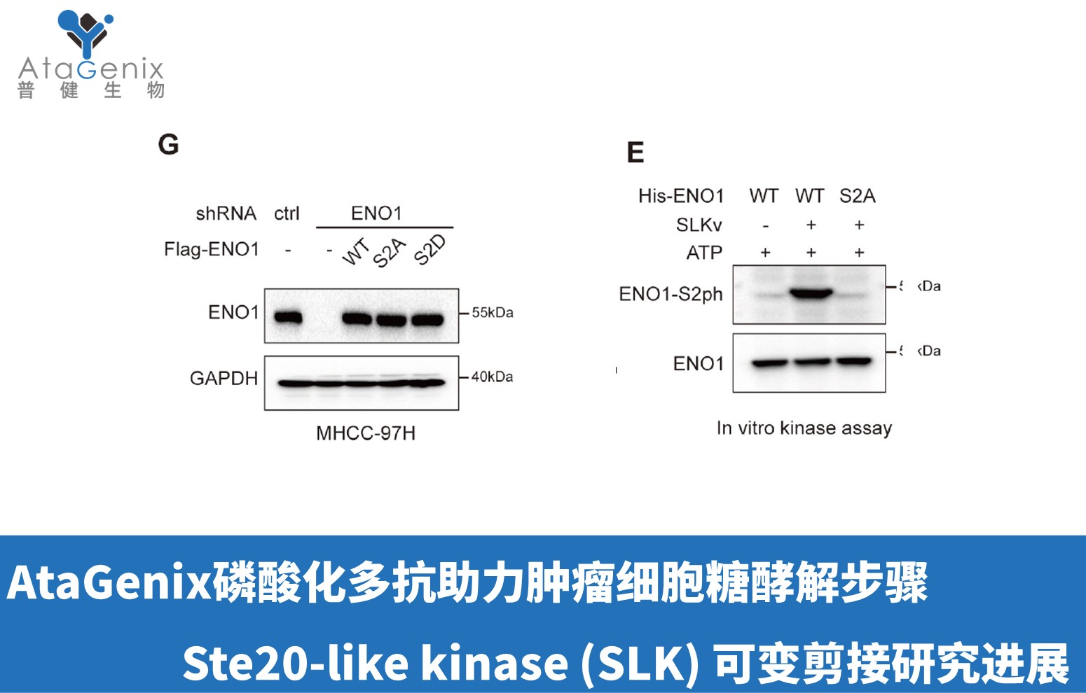AtaGenix磷酸化多抗助力腫瘤細(xì)胞糖酵解步驟Ste20-like kinase (SLK) 可變剪接研究進(jìn)展